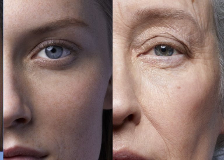 Comparación de dos rostros femeninos con y sin arrugas